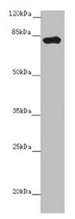 Western blot. All lanes: LRCH1 antibody at 15µg/ml + Hela whole cell lysate. Secondary. Goat polyclonal to rabbit IgG at 1/10000 dilution. Predicted band size: 81, 78, 85 kDa. Observed band size: 81 kDa