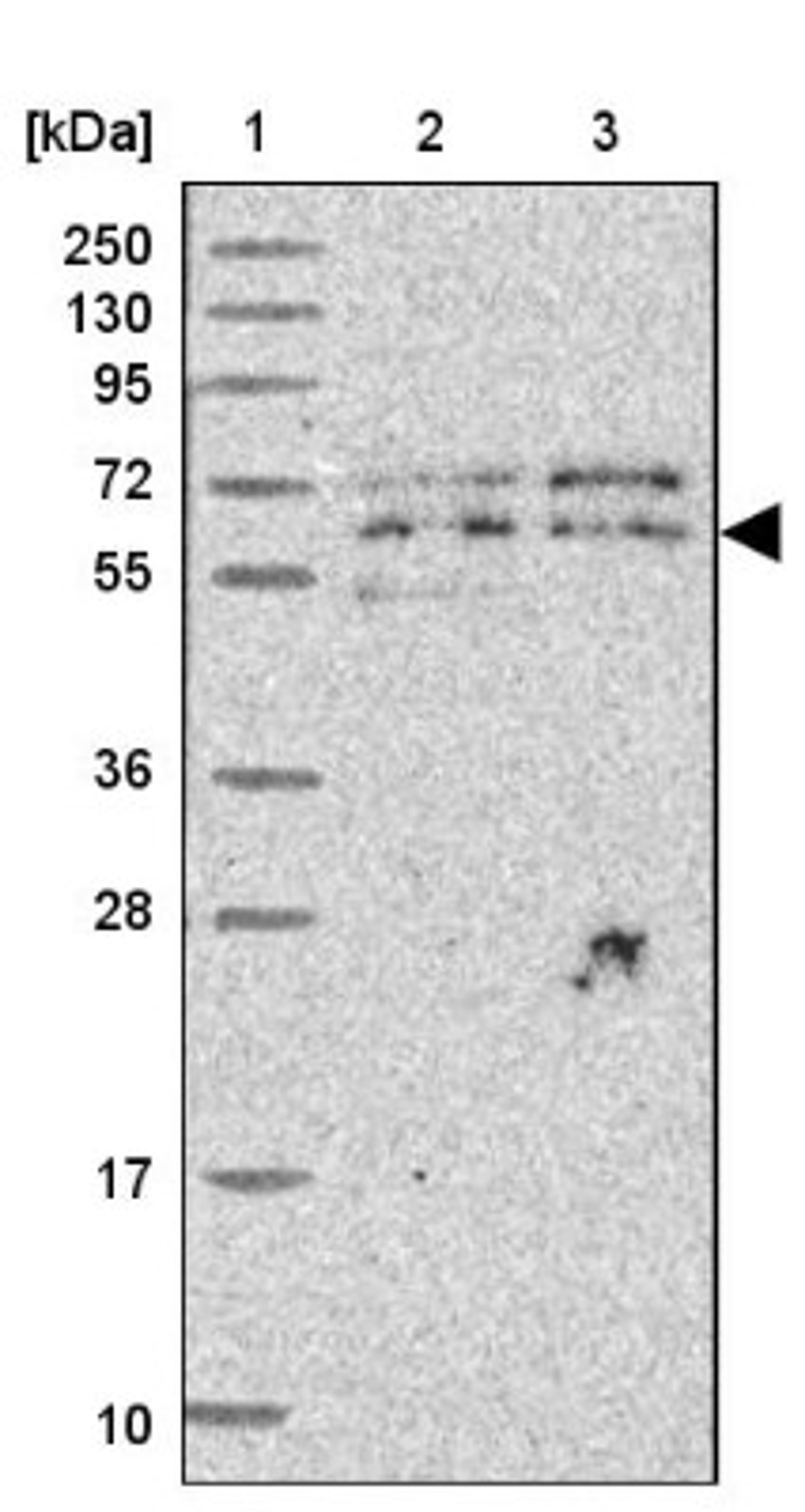 Western Blot: UTP18 Antibody [NBP2-13511] - Lane 1: Marker [kDa] 250, 130, 95, 72, 55, 36, 28, 17, 10<br/>Lane 2: Human cell line RT-4<br/>Lane 3: Human cell line U-251MG sp