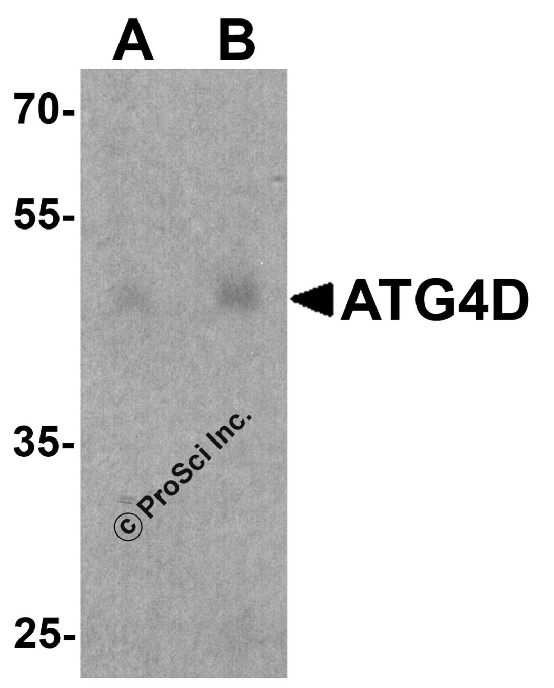 Western blot analysis of ATG4D in human testis tissue lysate with ATG4D antibody at (A) 1 and (B) 2 &#956;g/ml.