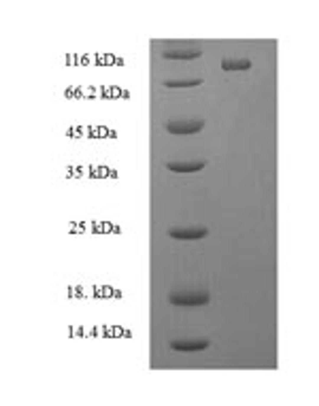 (Tris-Glycine gel) Discontinuous SDS-PAGE (reduced) with 5% enrichment gel and 15% separation gel.