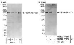 Western Blot: RB1CC1 Antibody [NB100-77279] - Detection of Human FIP200/RB1CC1 on HeLa whole cell lysate using NB100-77279. FIP200/RB1CC1 was also immunoprecipitated by rabbit anti-FIP200/RB1CC1 antibody NB100-77317.