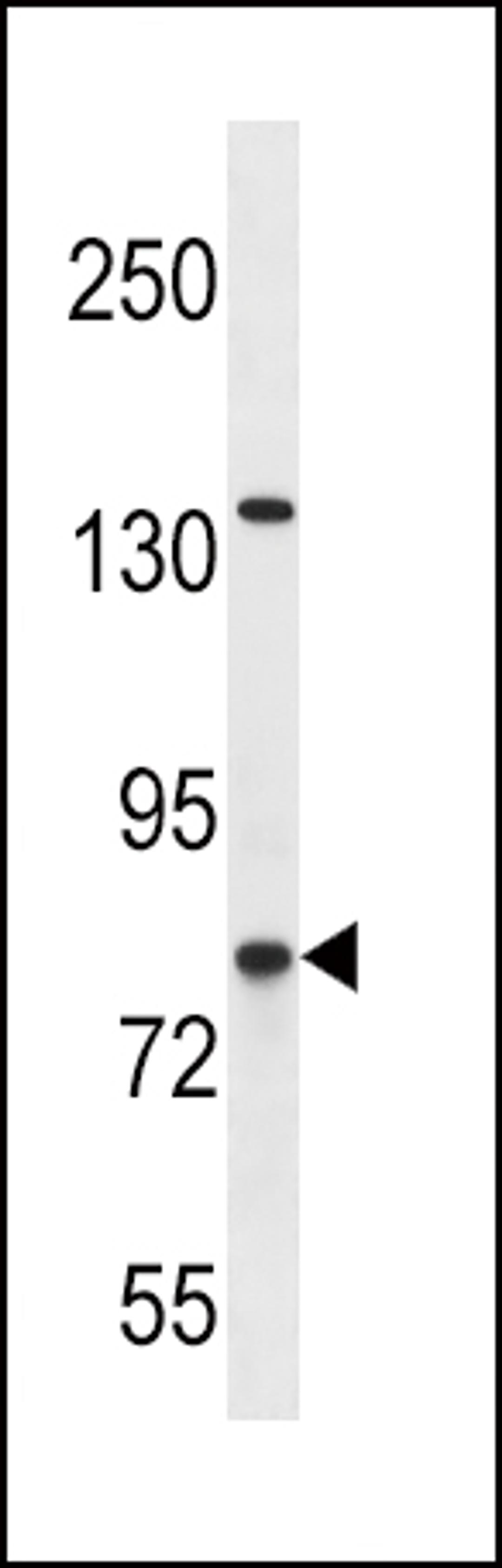 Western blot analysis in SK-BR-3 cell line lysates (35ug/lane).