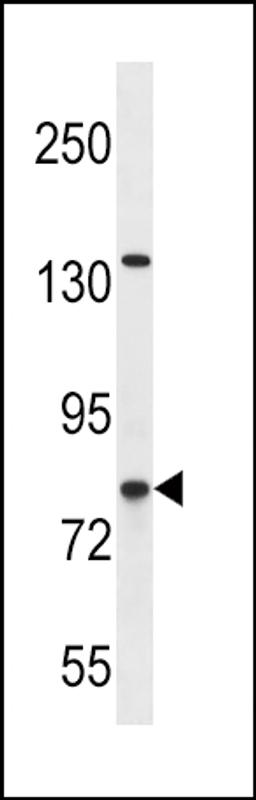 Western blot analysis in SK-BR-3 cell line lysates (35ug/lane).