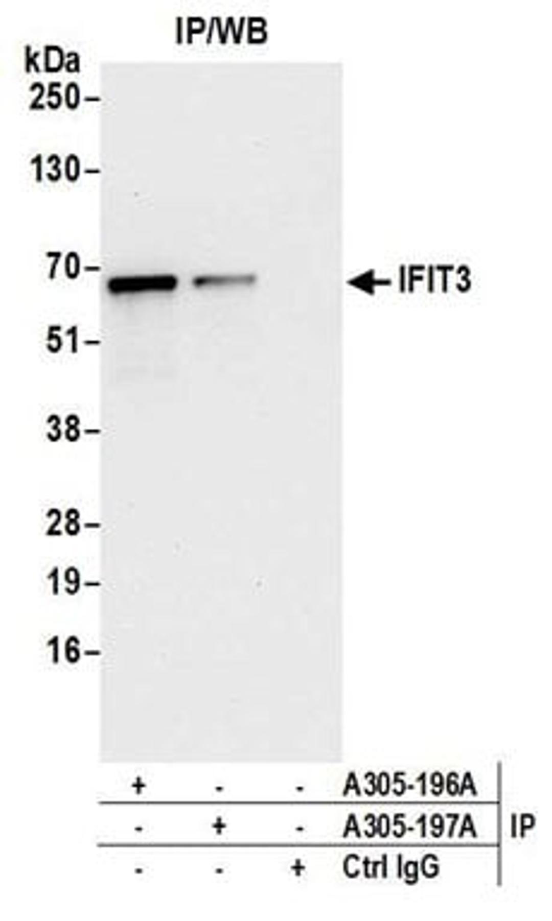 Detection of human IFIT3 by western blot of immunoprecipitates.