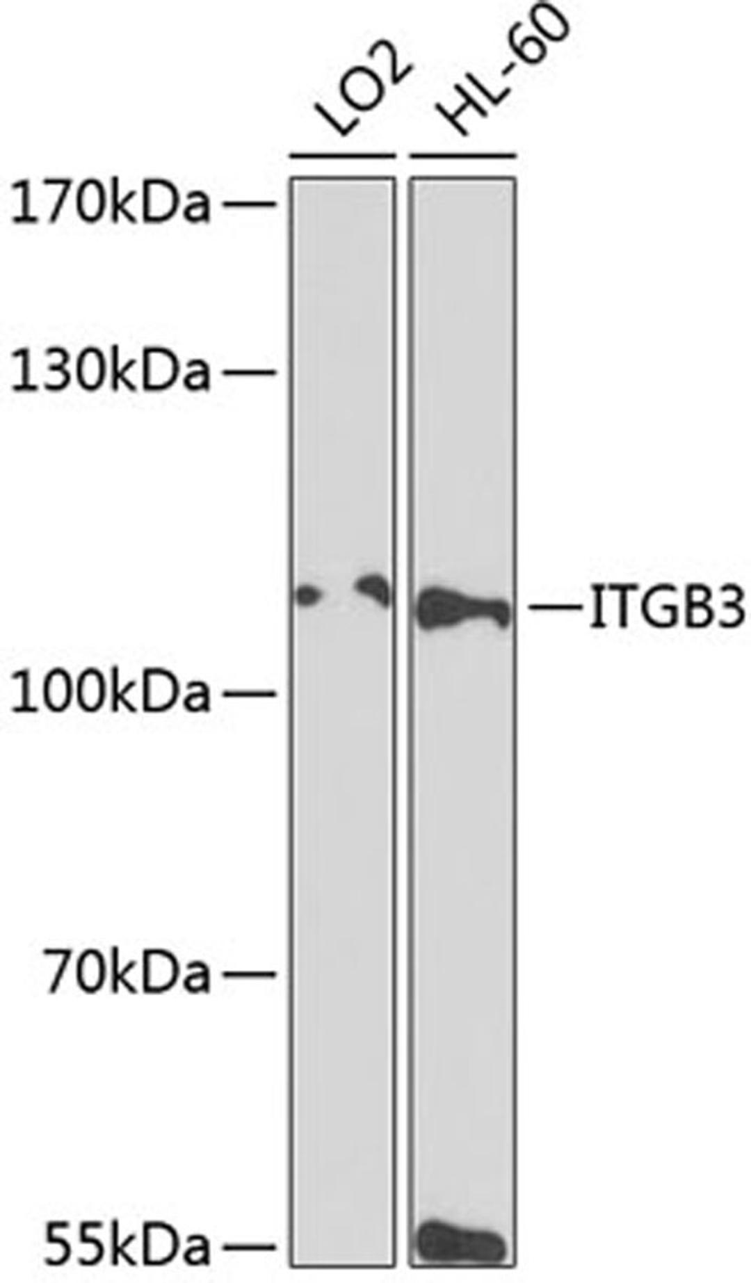 Western blot - ITGB3 antibody (A2542)