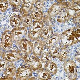 Immunohistochemical staining of rat spleen tissue using PTK2 antibody (dilution of 1:100)