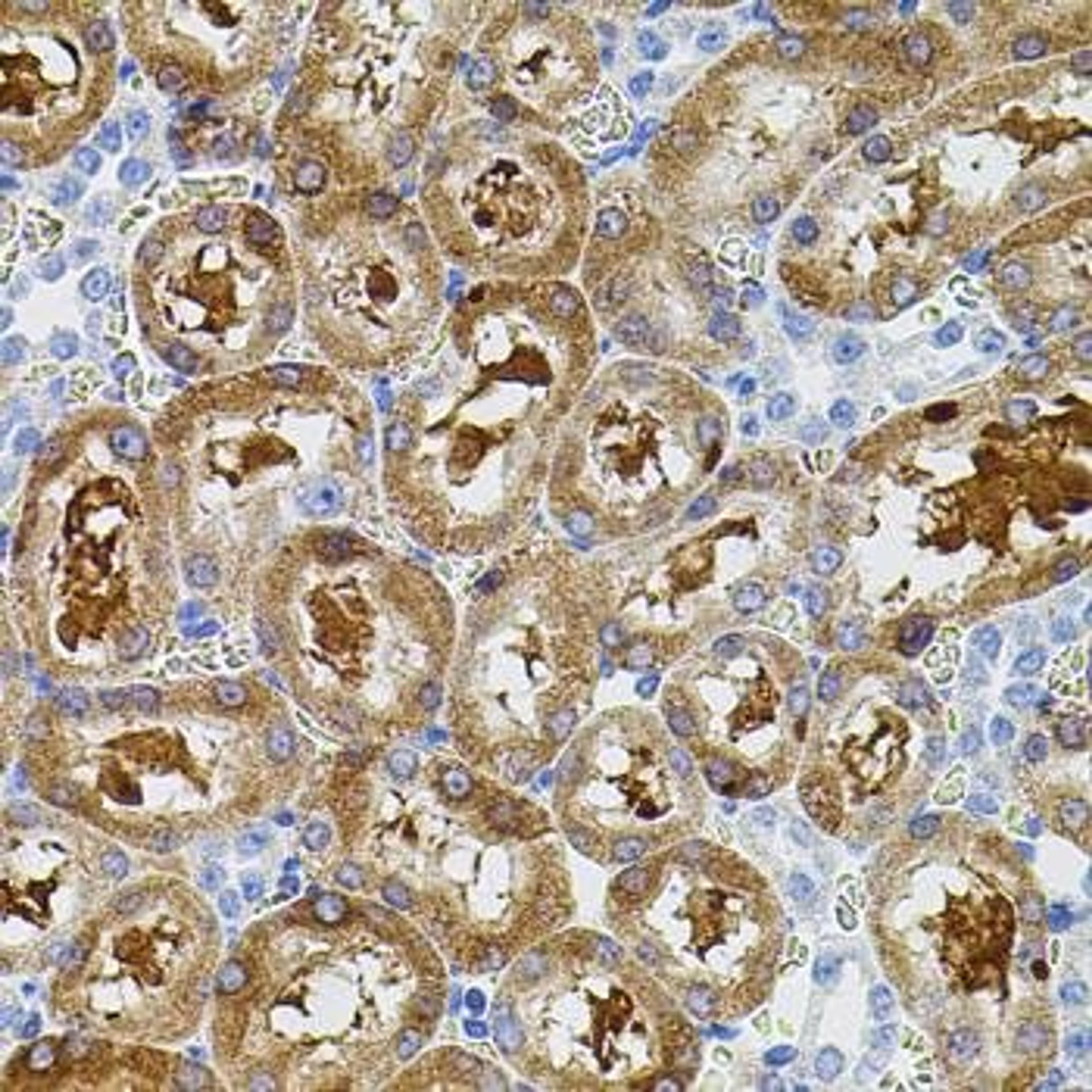 Immunohistochemical staining of rat spleen tissue using PTK2 antibody (dilution of 1:100)