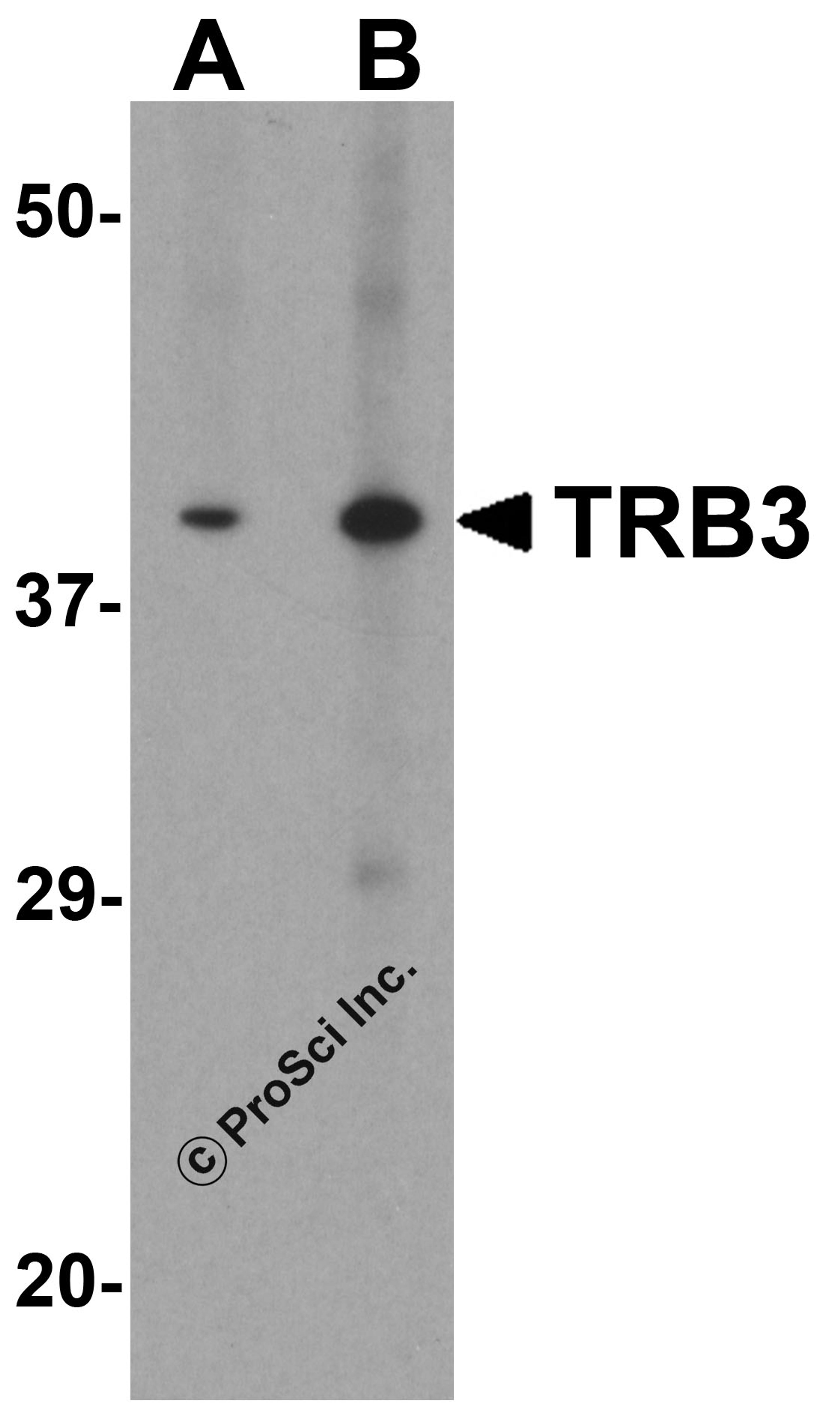 Western blot analysis of TRB3 in mouse kidney tissue lysate with TRB3 antibody at (A) 1 and (B) 2 μg/ml.