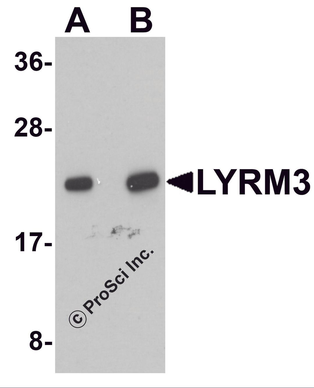 Western blot analysis of LYRM3 in human liver tissue lysate with LYRM3 antibody at (A) 1 and (B) 2 μg/mL.