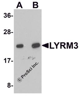 Western blot analysis of LYRM3 in human liver tissue lysate with LYRM3 antibody at (A) 1 and (B) 2 μg/mL.