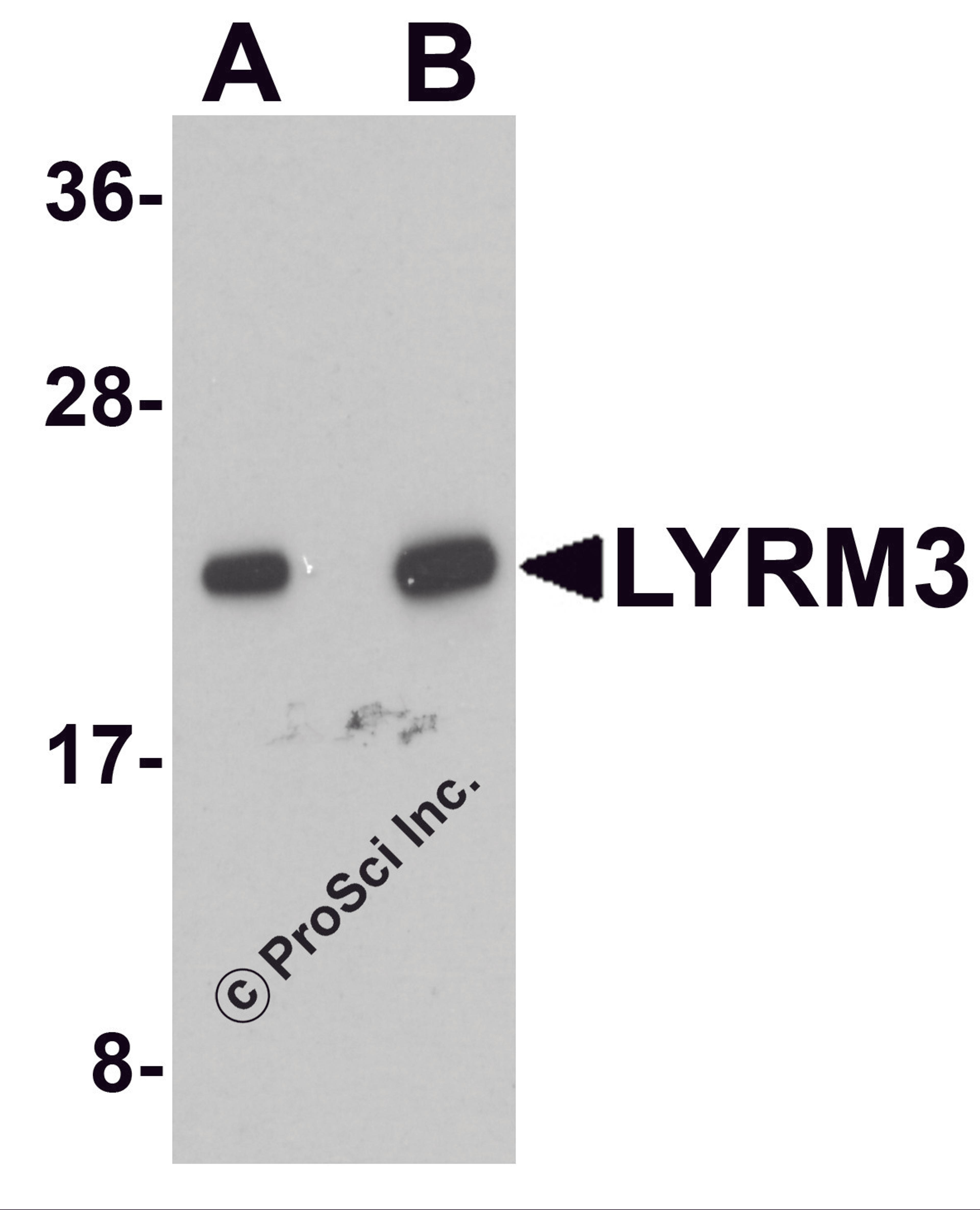 Western blot analysis of LYRM3 in human liver tissue lysate with LYRM3 antibody at (A) 1 and (B) 2 μg/mL.