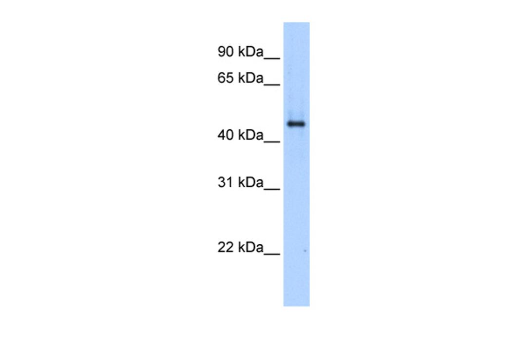 Antibody used in WB on Transfected 293T at 0.2-1 ug/ml.