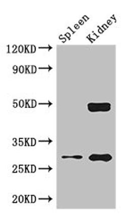 Western Blot. Positive WB detected in: Mouse lung tissue, Mouse kidney tissue. All lanes: DDAH2 antibody at 2.5ug/ml. Secondary. Goat polyclonal to rabbit IgG at 1/50000 dilution. Predicted band size: 30 kDa. Observed band size: 30, 50 kDa. 