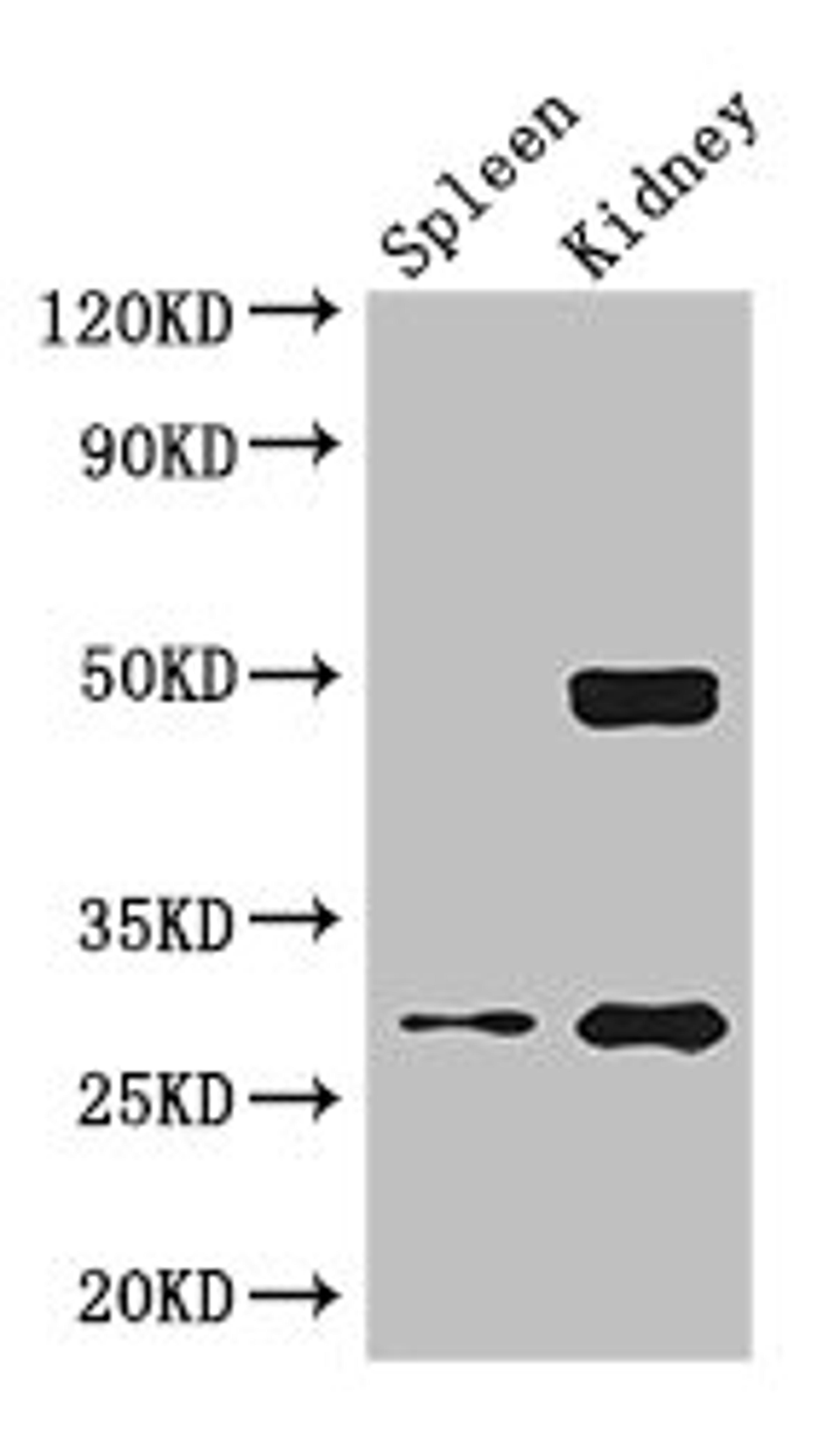 Western Blot. Positive WB detected in: Mouse lung tissue, Mouse kidney tissue. All lanes: DDAH2 antibody at 2.5ug/ml. Secondary. Goat polyclonal to rabbit IgG at 1/50000 dilution. Predicted band size: 30 kDa. Observed band size: 30, 50 kDa. 