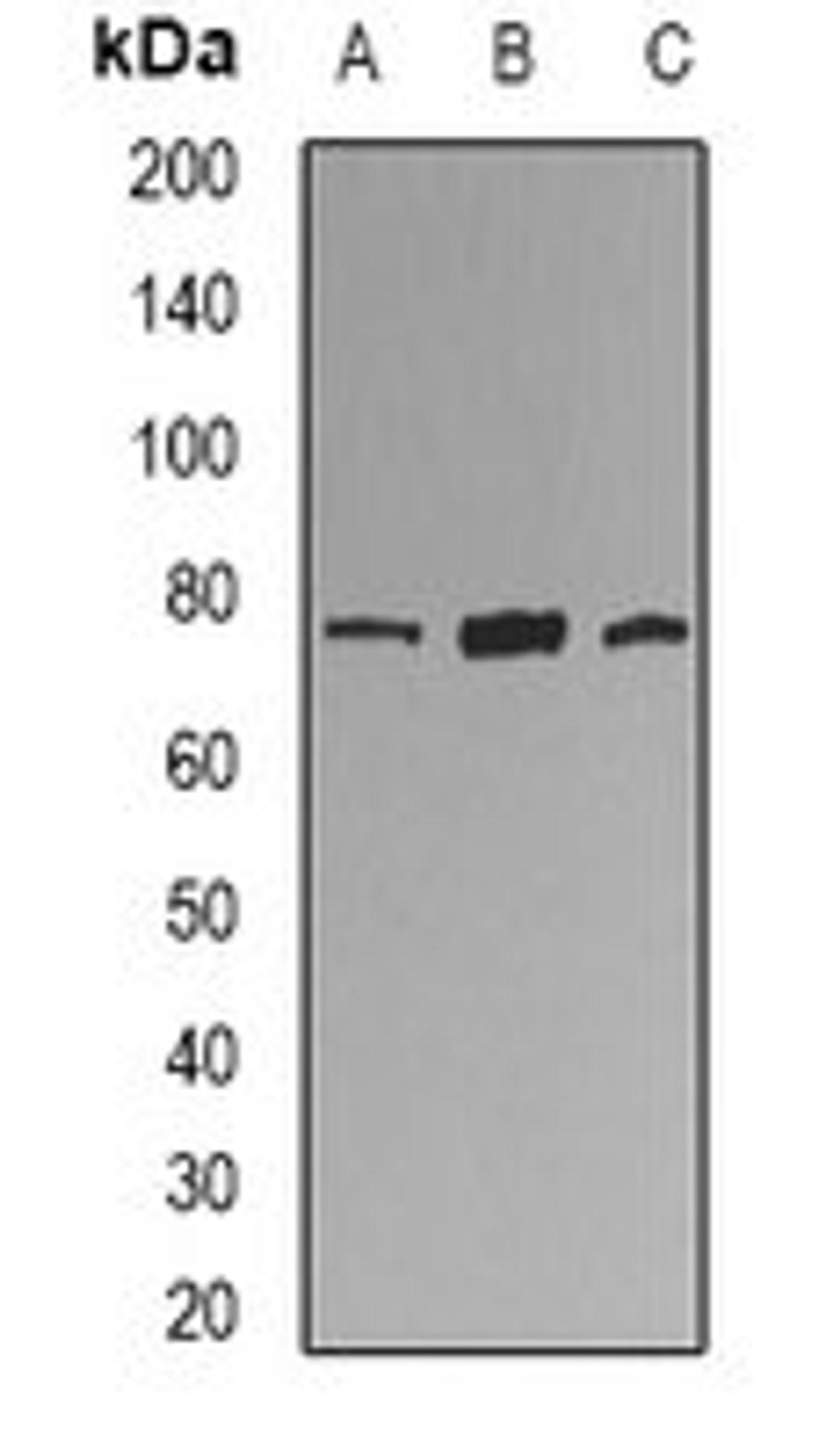 Western blot analysis of U937 (Lane1), mouse lung (Lane2), rat lung (Lane3) whole cell lysates using KIF2B antibody