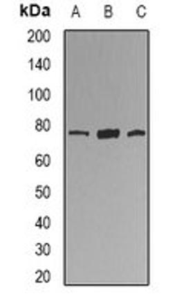 Western blot analysis of U937 (Lane1), mouse lung (Lane2), rat lung (Lane3) whole cell lysates using KIF2B antibody