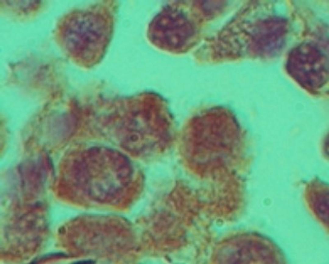 Immunohistochemistry-Paraffin: Rhox11 Antibody [NBP2-23830] - Analysis of Rhox-11 in formalin-fixed, paraffin-embedded mouse testis tissue using this antibody at 1:100.