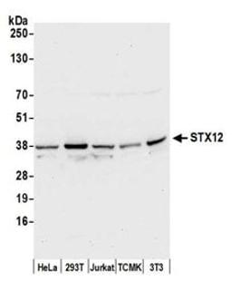 Detection of human and mouse STX12 by western blot.