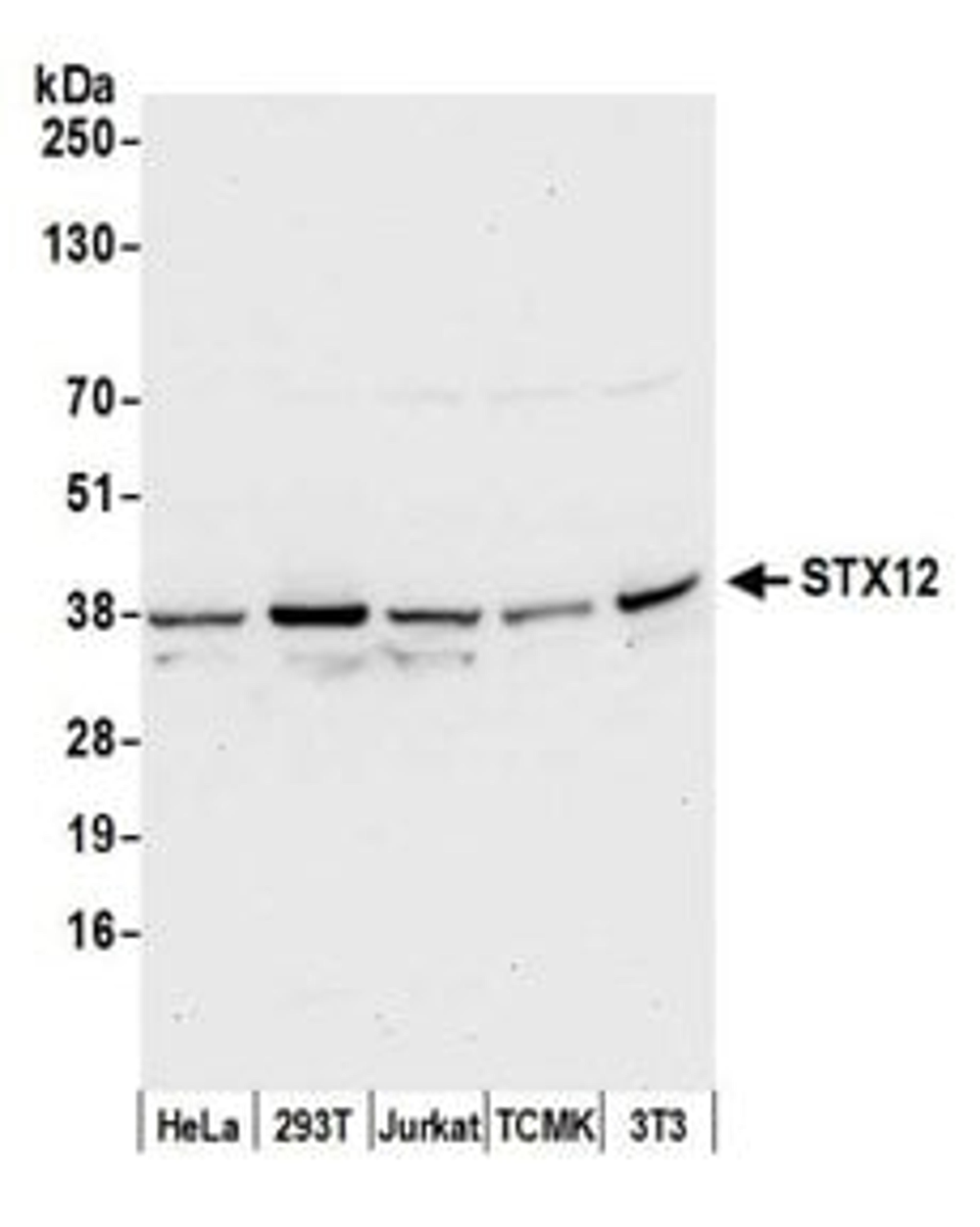 Detection of human and mouse STX12 by western blot.