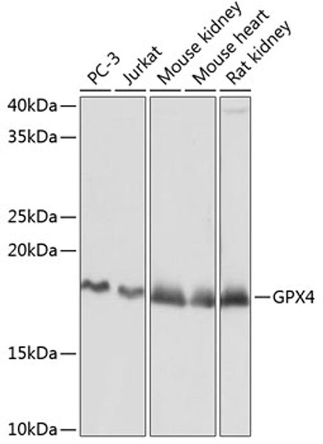 Western blot - GPX4 Rabbit mAb (A11243)
