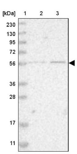 Western Blot: ZNF695 Antibody [NBP1-80783] - Lane 1: Marker [kDa] 230, 130, 95, 72, 56, 36, 28, 17, 11<br/>Lane 2: Human cell line RT-4<br/>Lane 3: Human cell line U-251MG sp