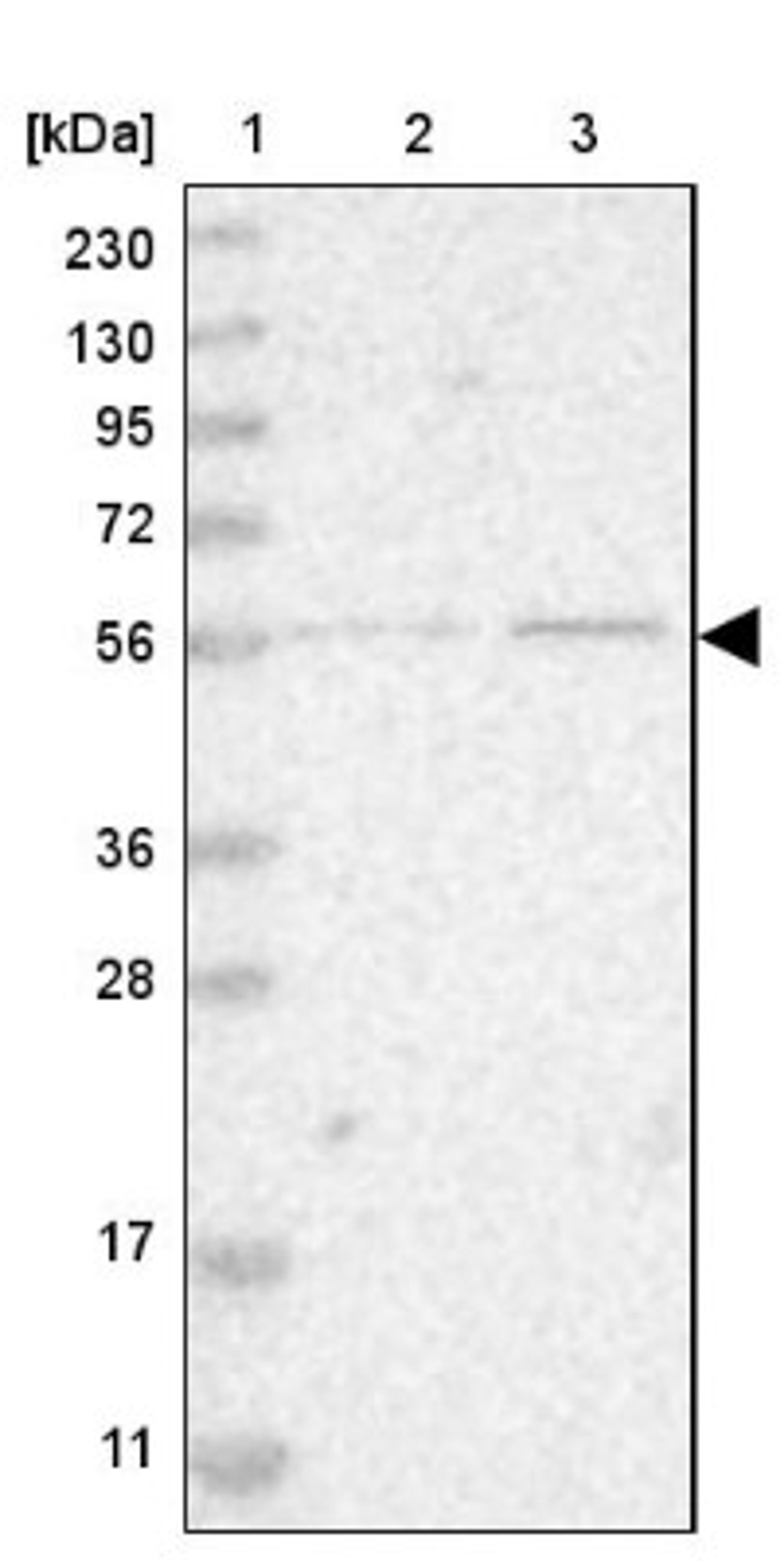 Western Blot: ZNF695 Antibody [NBP1-80783] - Lane 1: Marker [kDa] 230, 130, 95, 72, 56, 36, 28, 17, 11<br/>Lane 2: Human cell line RT-4<br/>Lane 3: Human cell line U-251MG sp