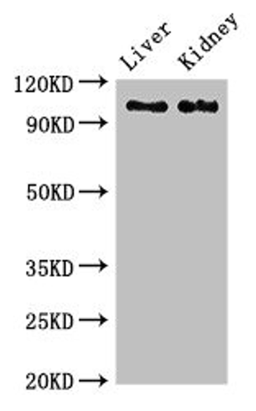 Western Blot. Positive WB detected in: Rat liver tissue, Mouse kidney tissue. All lanes: C6 antibody at 2.7ug/ml. Secondary. Goat polyclonal to rabbit IgG at 1/50000 dilution. Predicted band size: 105 kDa. Observed band size: 105 kDa. 