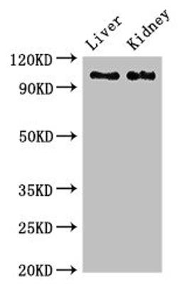 Western Blot. Positive WB detected in: Rat liver tissue, Mouse kidney tissue. All lanes: C6 antibody at 2.7ug/ml. Secondary. Goat polyclonal to rabbit IgG at 1/50000 dilution. Predicted band size: 105 kDa. Observed band size: 105 kDa. 