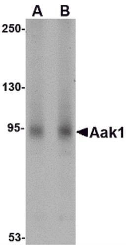 Western blot analysis of Aak1 in A-20 lysate with Aak1 antibody at (A) 1 and (B) 2 &#956;g/mL.