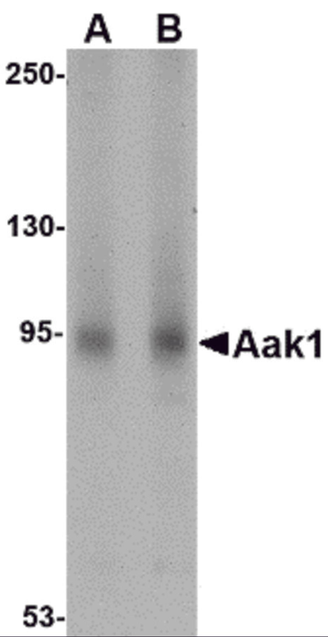 Western blot analysis of Aak1 in A-20 lysate with Aak1 antibody at (A) 1 and (B) 2 μg/mL.