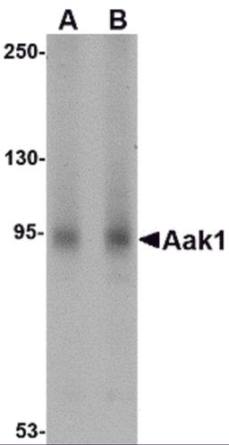 Western blot analysis of Aak1 in A-20 lysate with Aak1 antibody at (A) 1 and (B) 2 μg/mL.
