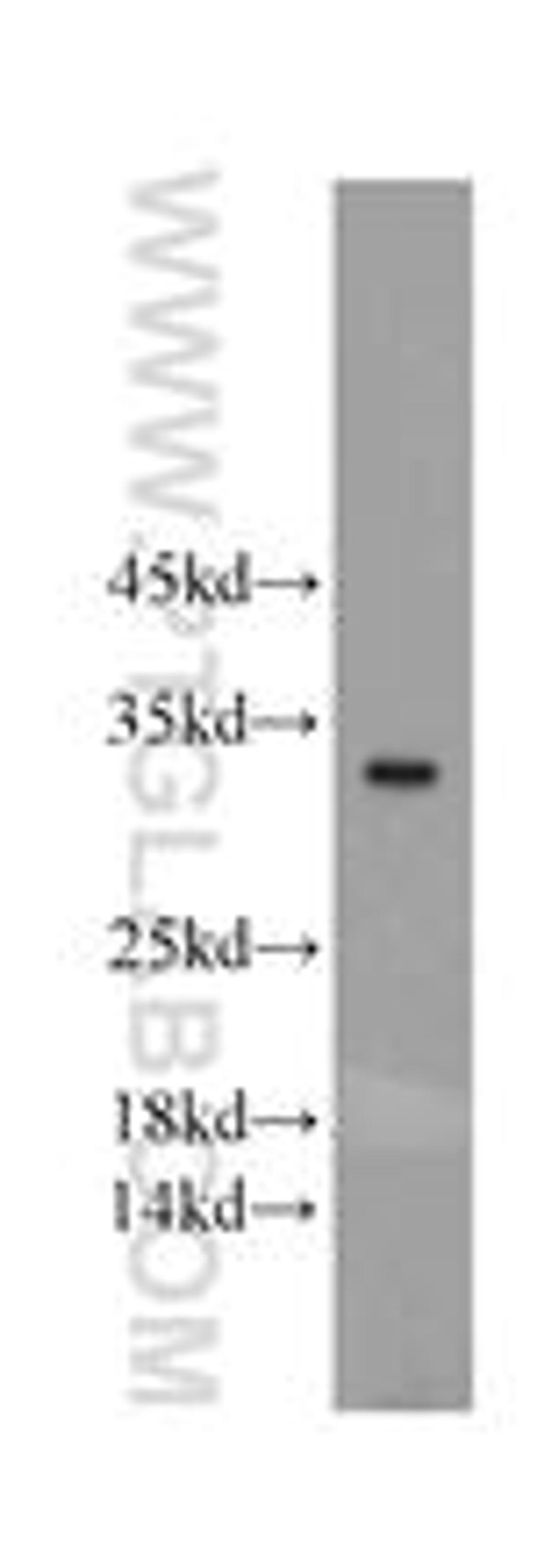 mouse colon tissue were subjected to SDS PAGE followed by western blot with 20760-1-AP(FAM57B antibody) at dilution of 1:500 incubated at room temperature for 1.5 hours