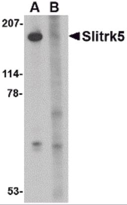 Western blot analysis of Slitrk5 in 3T3 cell lysate with Slitrk5 antibody at 1 &#956;g/mL in the (A) absence or (B) presence of blocking peptide.