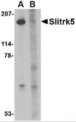 Western blot analysis of Slitrk5 in 3T3 cell lysate with Slitrk5 antibody at 1 μg/mL in the (A) absence or (B) presence of blocking peptide.