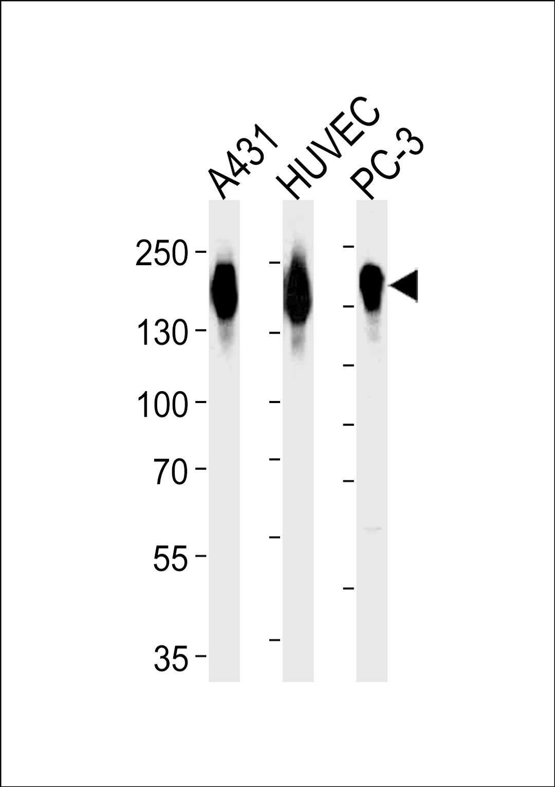 Western blot analysis of lysates from A431, HUVEC, PC-3 cell line (from left to right), using EGFR Antibody (pS1026) at 1:1000 at each lane.