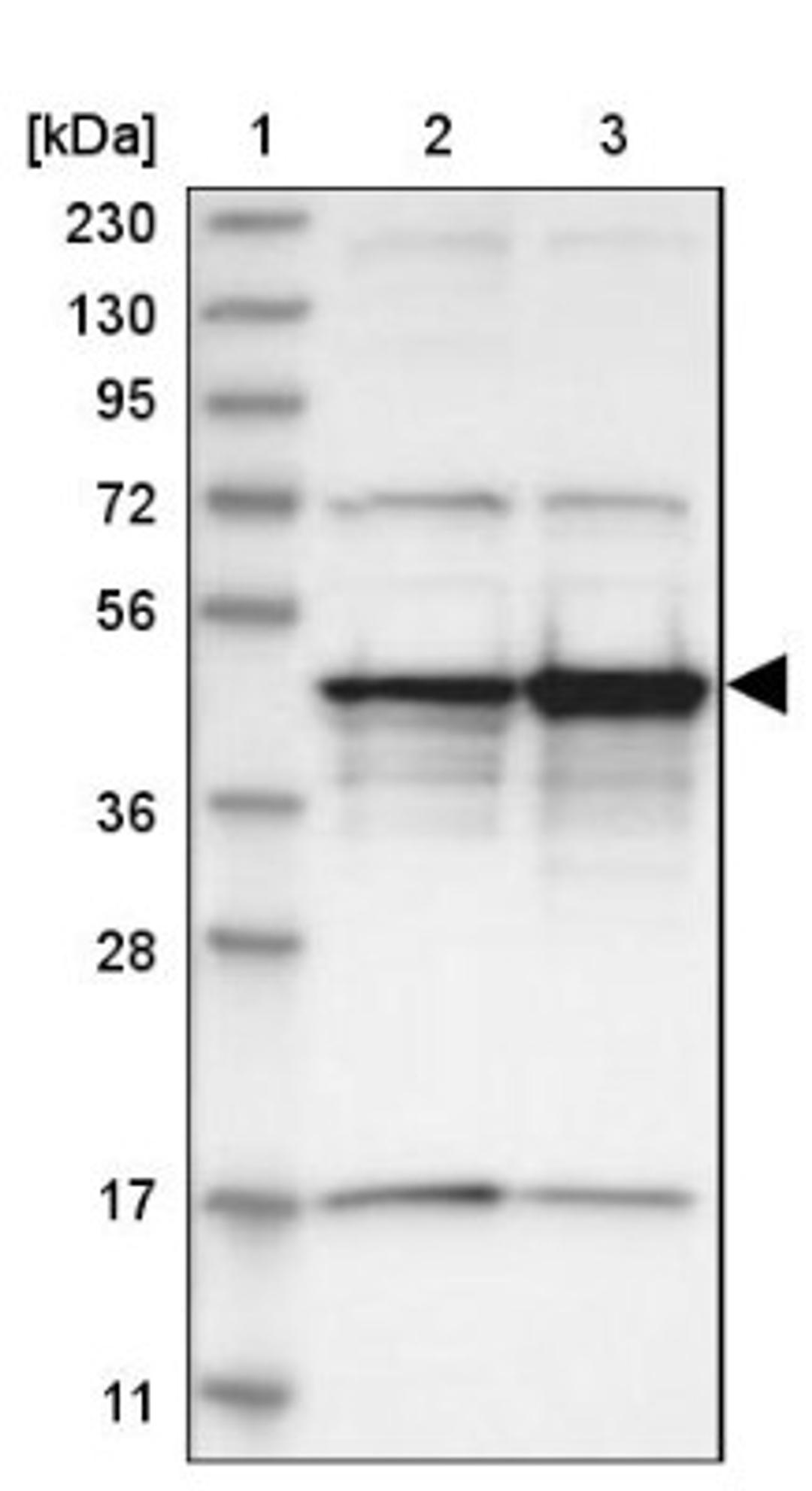 Western Blot: Surf6 Antibody [NBP1-83550] - Lane 1: Marker [kDa] 230, 130, 95, 72, 56, 36, 28, 17, 11<br/>Lane 2: Human cell line RT-4<br/>Lane 3: Human cell line U-251MG sp