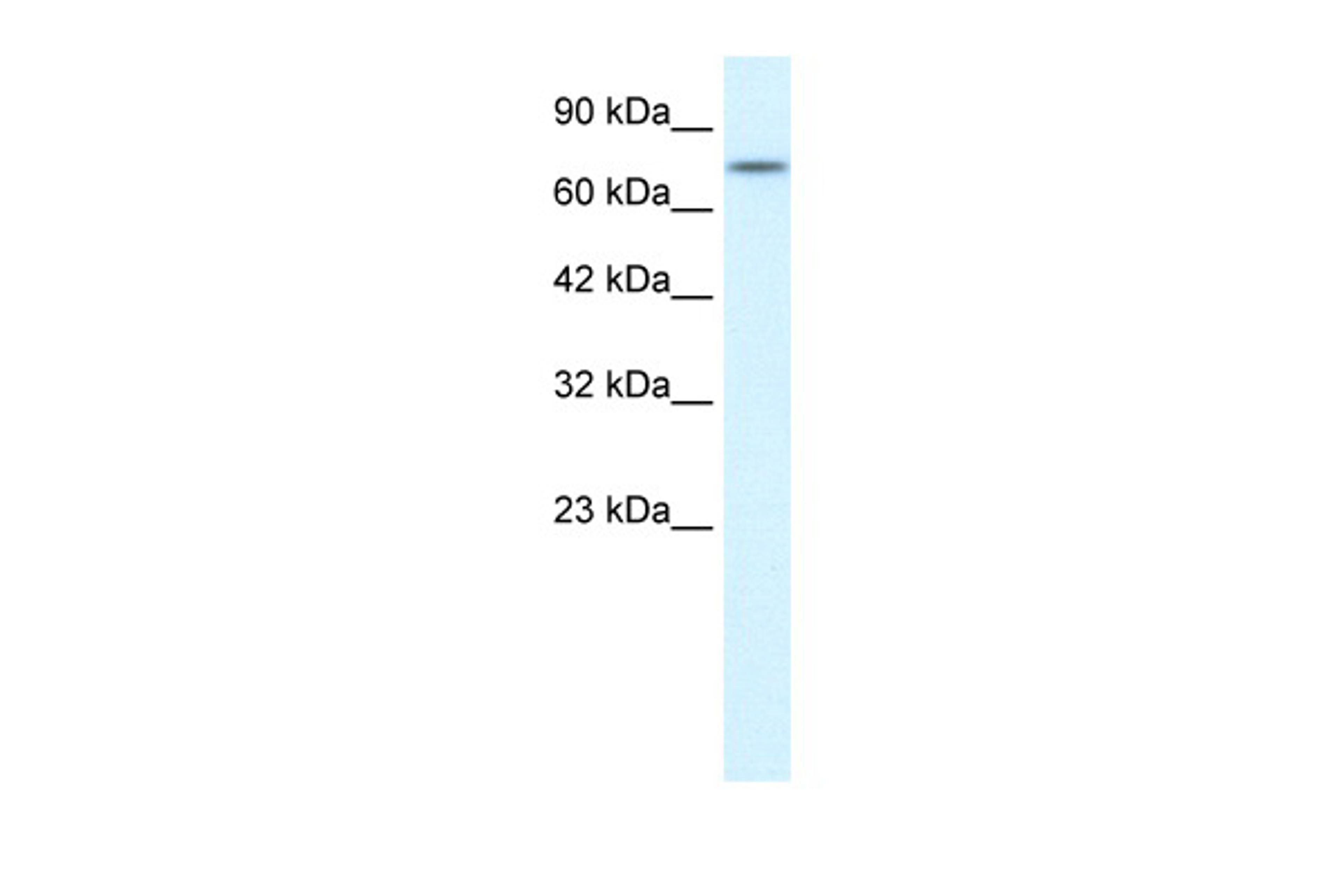 Antibody used in WB on Human HepG2 at 0.2-1 ug/ml.