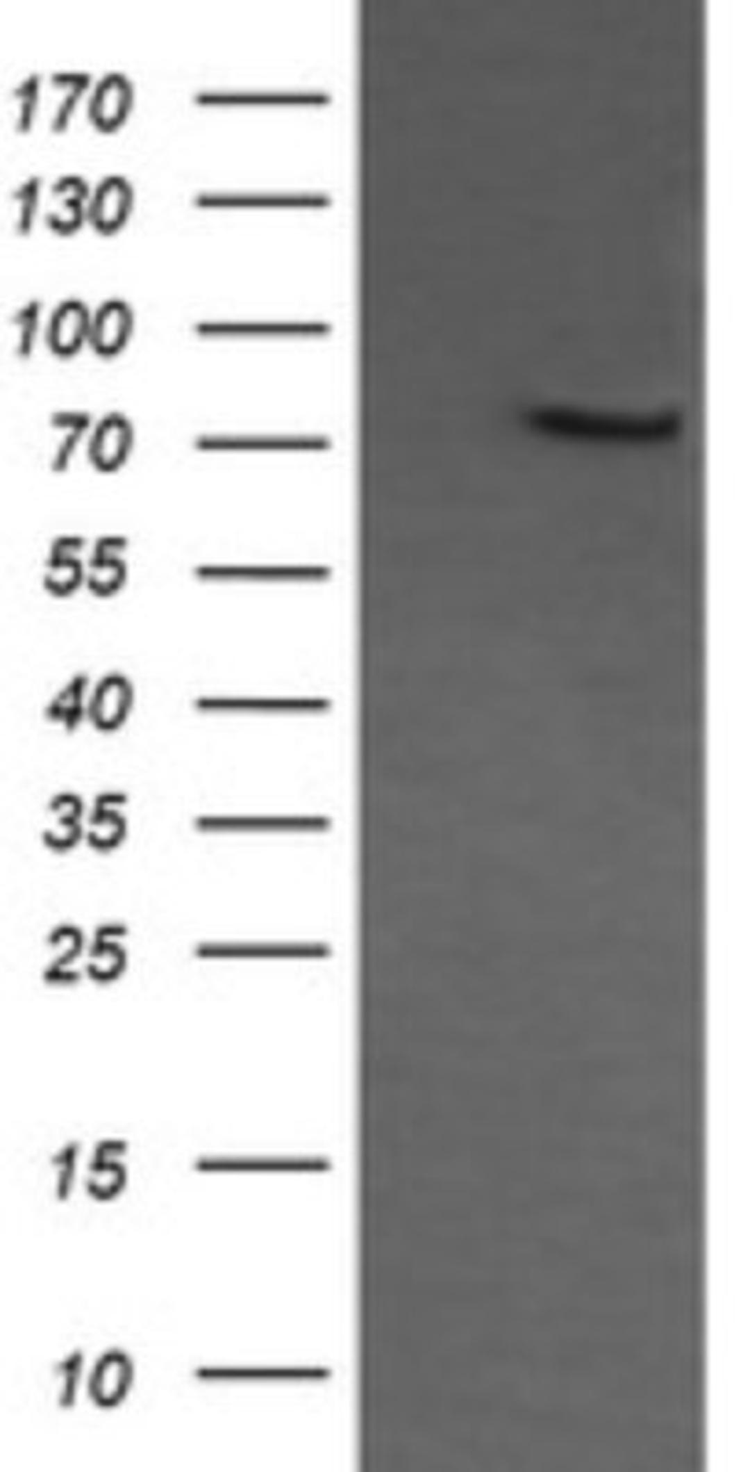 Western Blot: COG6 Antibody (1B8) [NBP2-45631] - Analysis of HEK293T cells were transfected with the pCMV6-ENTRY control (Left lane) or pCMV6-ENTRY COG6.