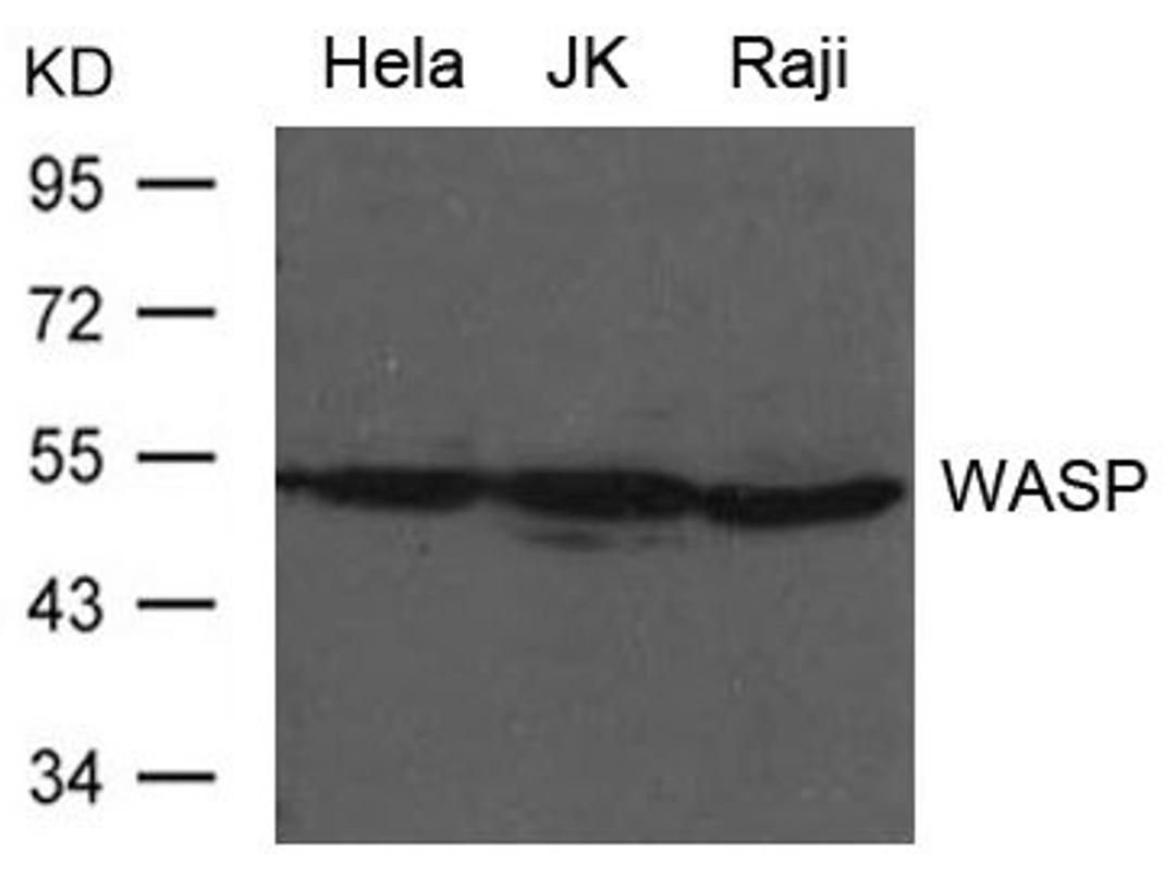 Western blot analysis of Hela, JK and Raji cells using WASP antibody