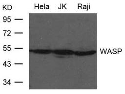 Western blot analysis of Hela, JK and Raji cells using WASP antibody