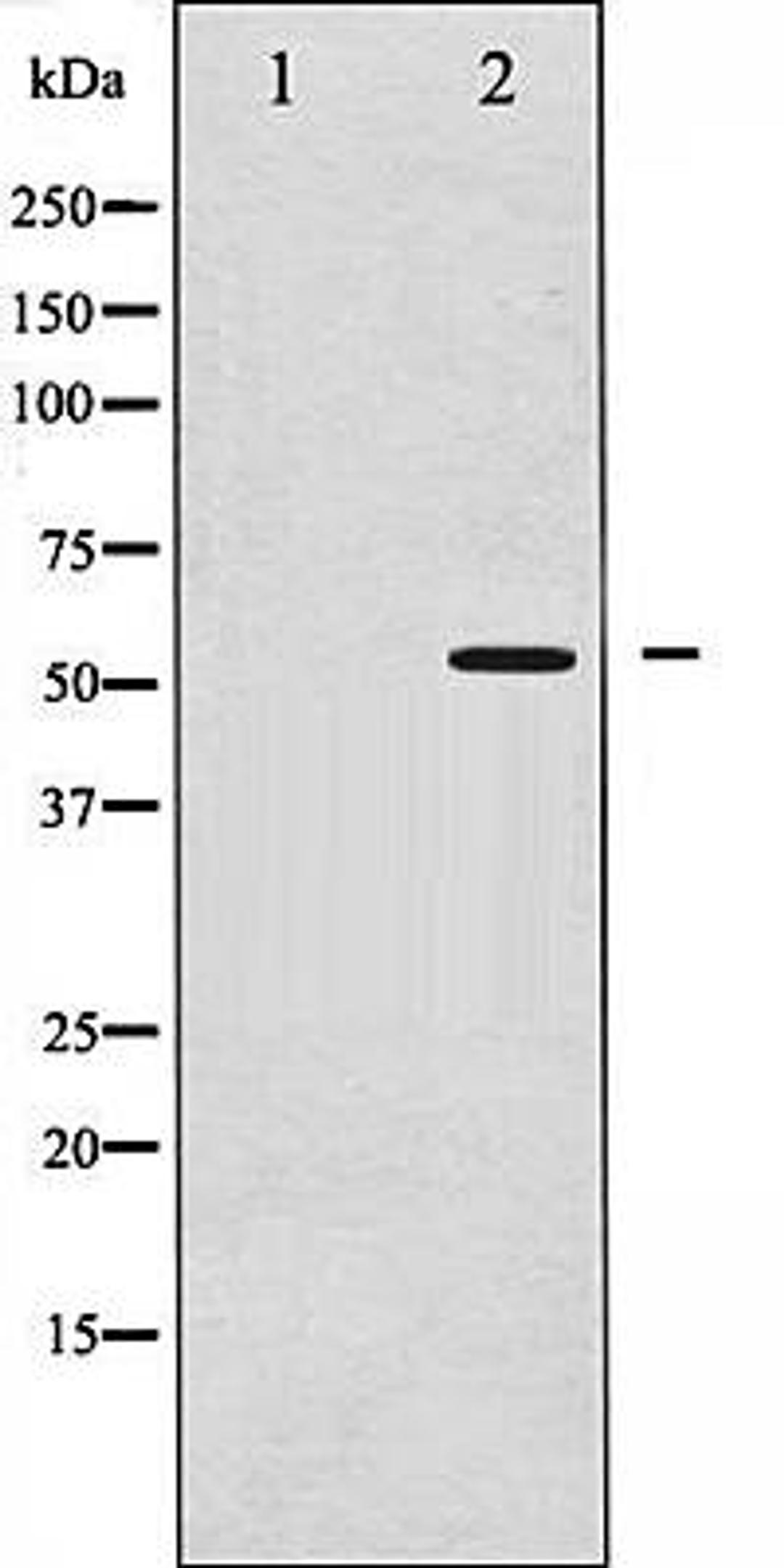 Western blot analysis on Jurkat treated with Paclitaxel using phospho-PPAR- gamma (Ser112) Antibody,The lane on the left is blocked with the antigen-specific peptide