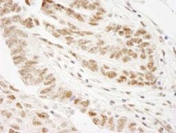 Detection of human WTAP by immunohistochemistry.