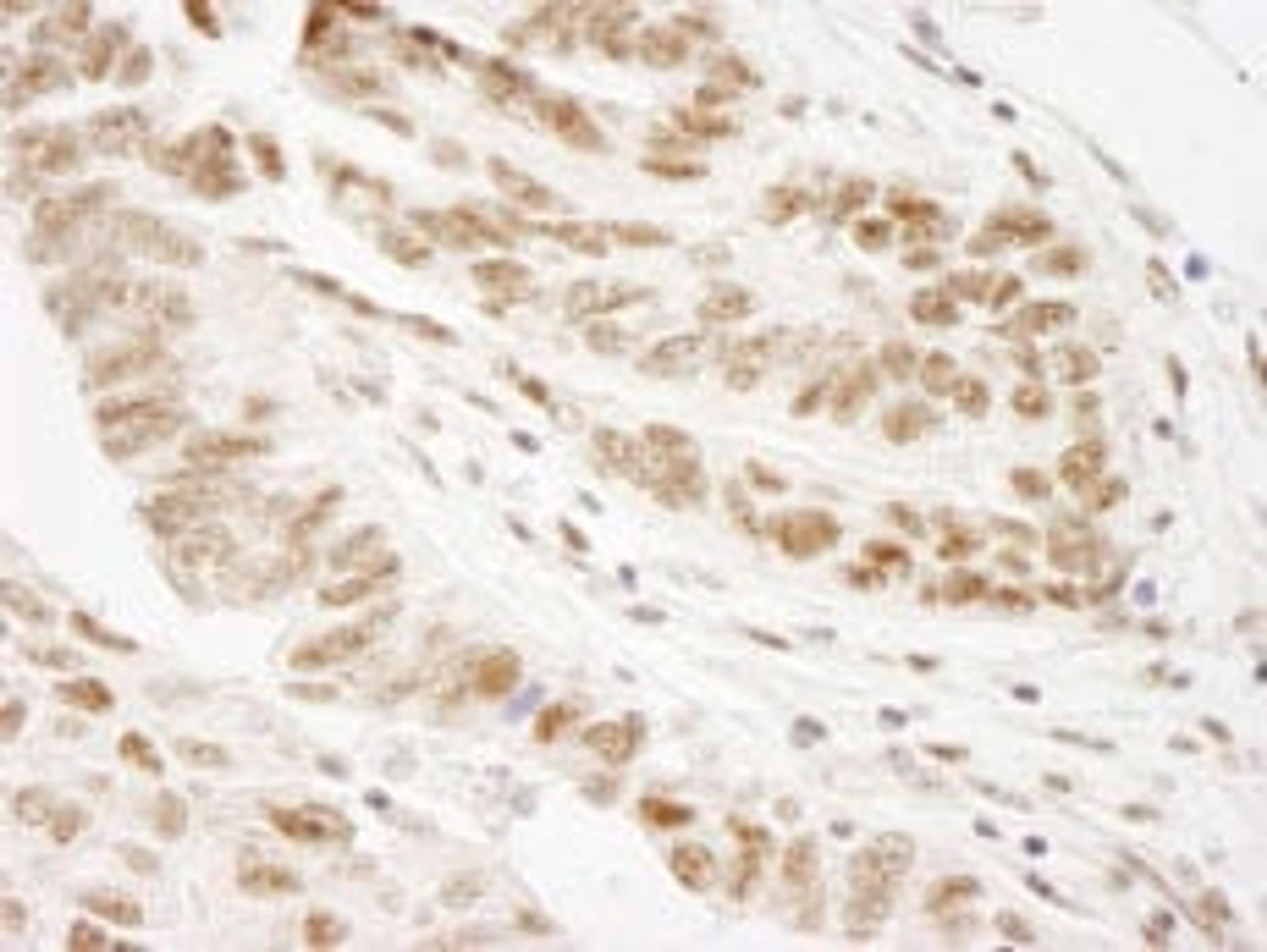 Detection of human WTAP by immunohistochemistry.