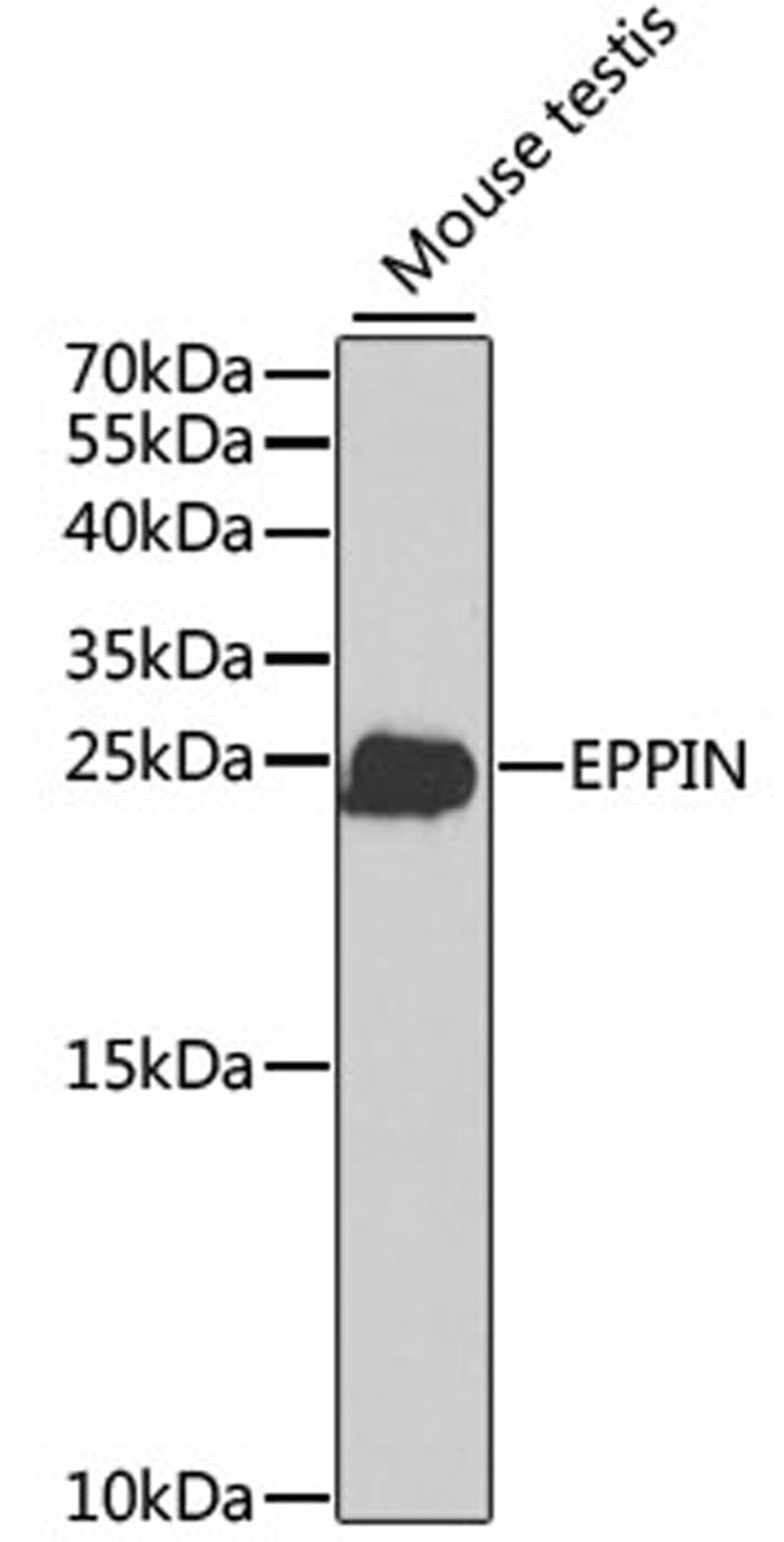 Western blot - EPPIN antibody (A2149)