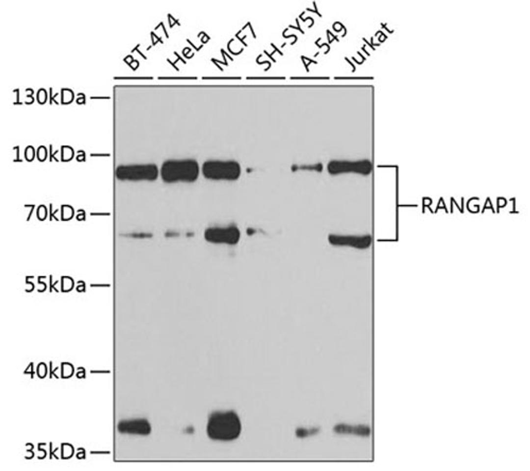 Western blot - RANGAP1 antibody (A13347)