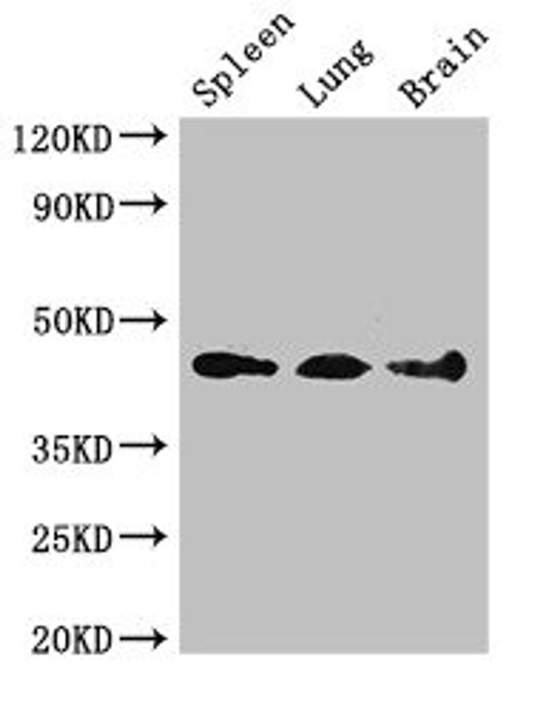 Western Blot. Positive WB detected in: Mouse spleen tissue, Mouse lung tissue, Mouse brain tissue. All lanes: NCF1 antibody at 3ug/ml. Secondary. Goat polyclonal to rabbit IgG at 1/50000 dilution. Predicted band size: 45, 31 kDa. Observed band size: 45 kDa. 