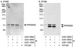 Detection of human PPP2R5D by western blot of immunoprecipitates.