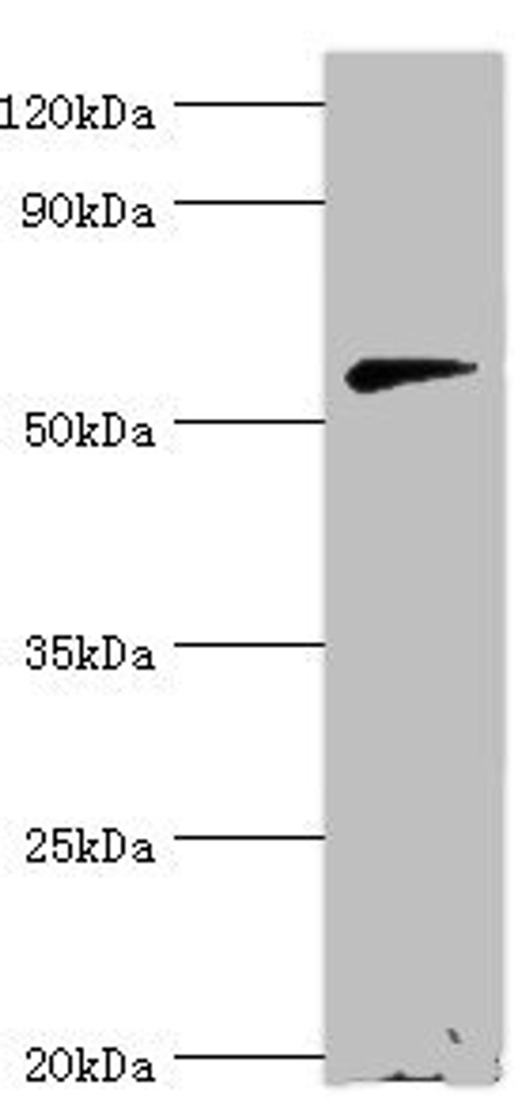 Western blot. All lanes: Beta-Ala-His dipeptidase antibody at 2ug/ml + 293T whole cell lysate. Secondary. Goat polyclonal to rabbit IgG at 1/10000 dilution. Predicted band size: 57 kDa. Observed band size: 57 kDa. 