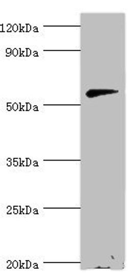 Western blot. All lanes: Beta-Ala-His dipeptidase antibody at 2ug/ml + 293T whole cell lysate. Secondary. Goat polyclonal to rabbit IgG at 1/10000 dilution. Predicted band size: 57 kDa. Observed band size: 57 kDa. 