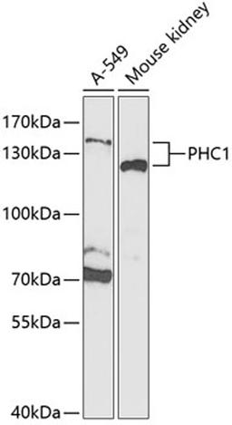 Western blot - PHC1 Antibody (A5843)